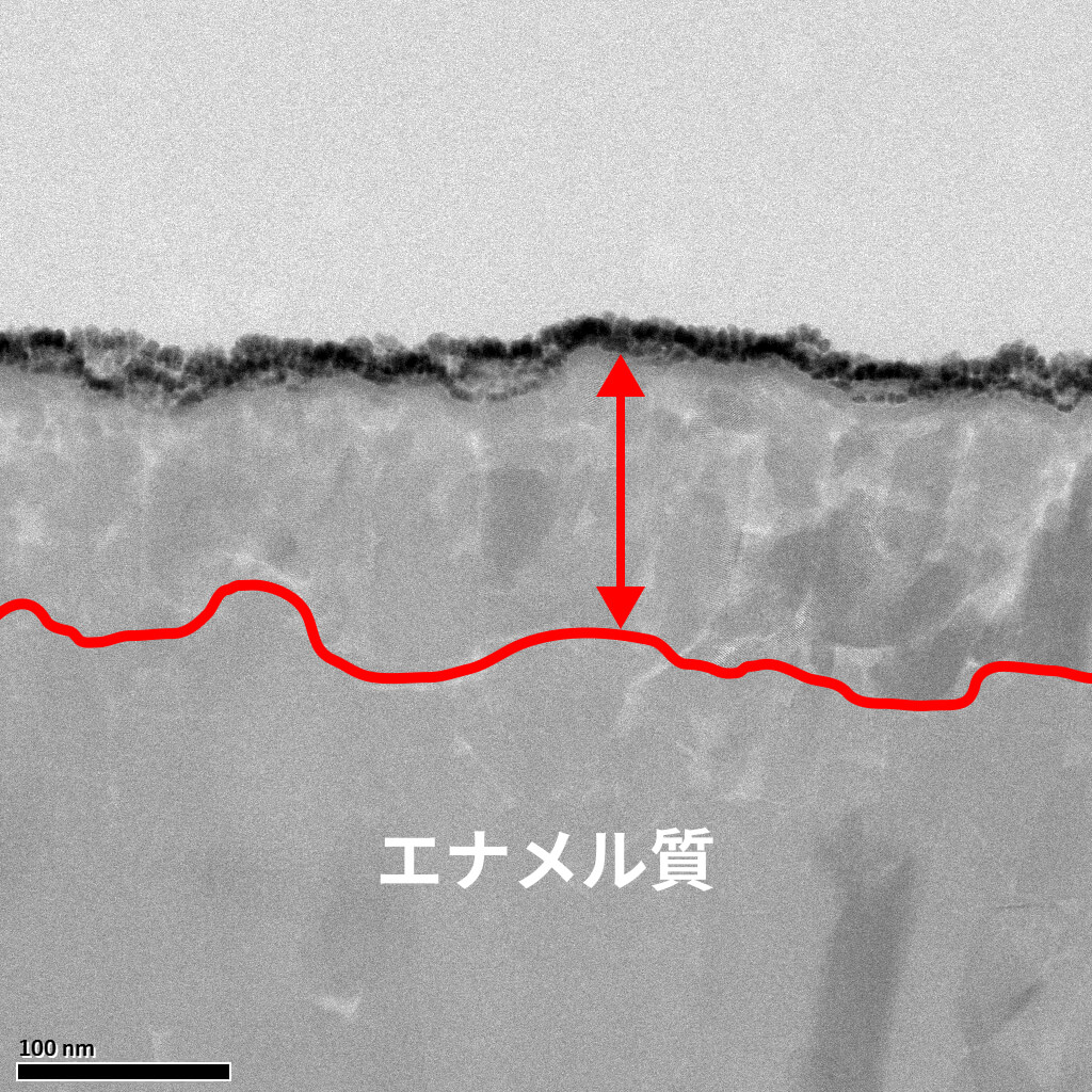 結晶新生のエナメル質画像